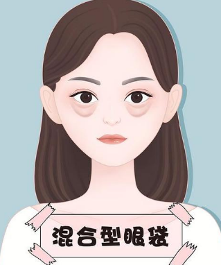 眼袋