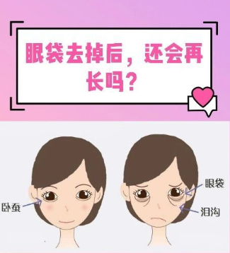 去眼袋手术