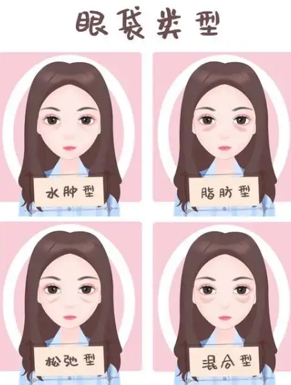 去眼袋手术