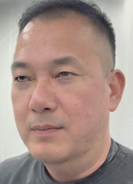 去眼袋手术