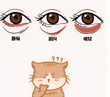 去眼袋手术