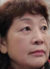 去眼袋手术