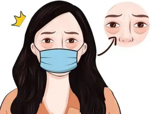去眼袋手术