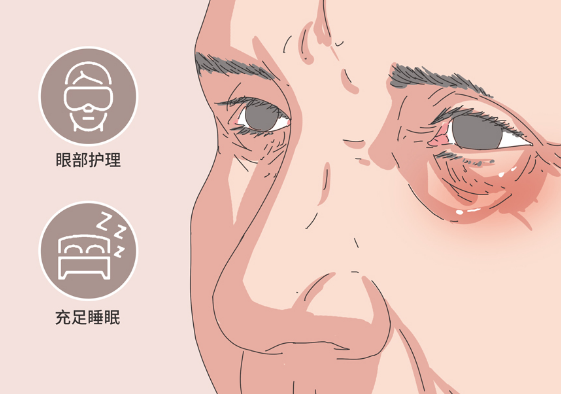 去眼袋手术