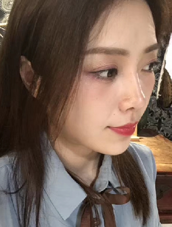 去眼袋手术