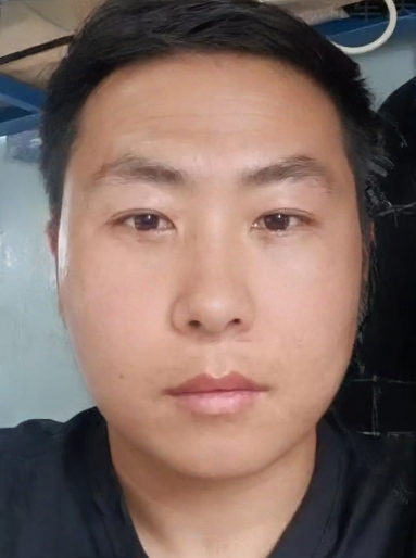 去眼袋手术
