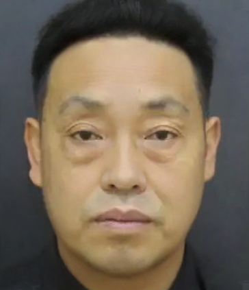 去眼袋手术