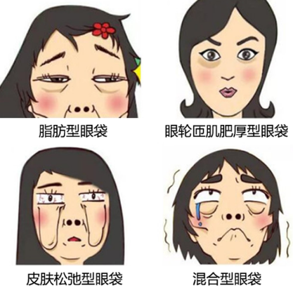 去眼袋手术