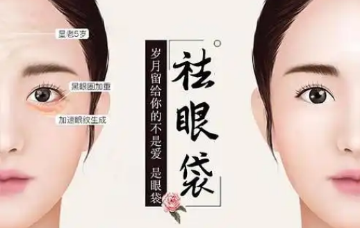 去眼袋手术