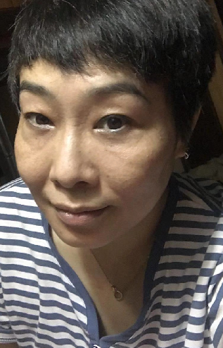 去眼袋手术
