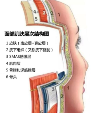 去眼袋手术