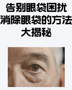 去眼袋手术