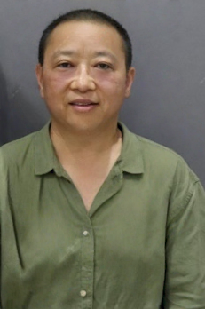 去眼袋手术