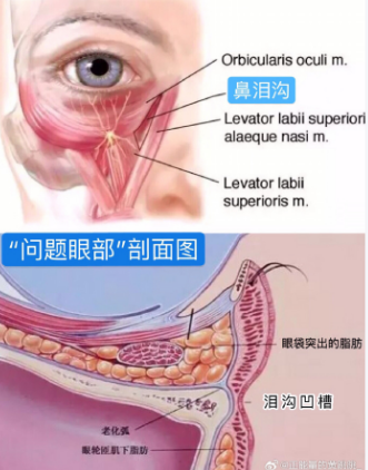 眼袋