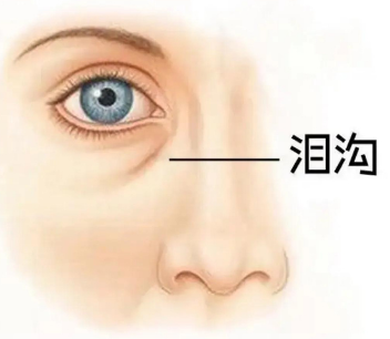 眼袋