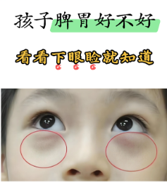 去眼袋手术