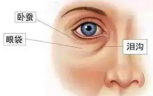 眼袋