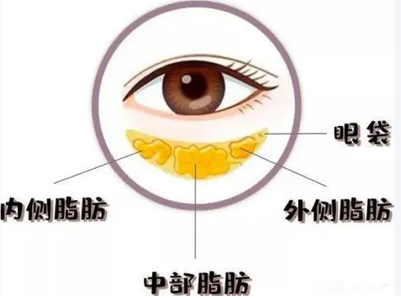 眼袋