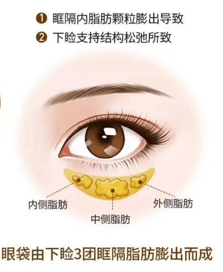 眼袋