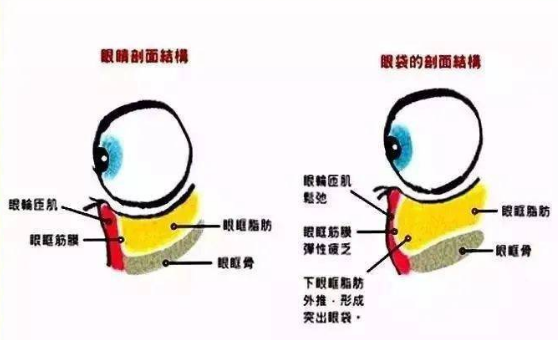 眼袋