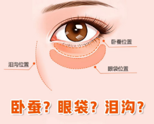 眼袋