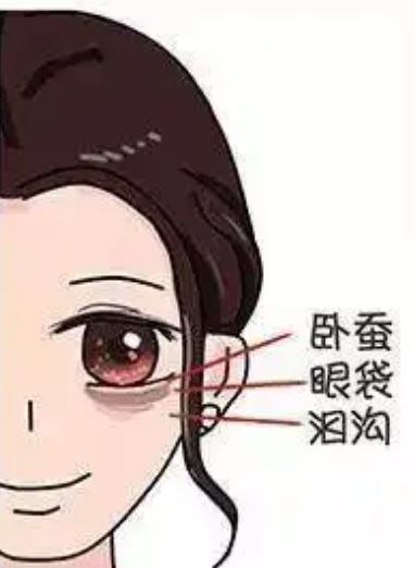 去眼袋手术