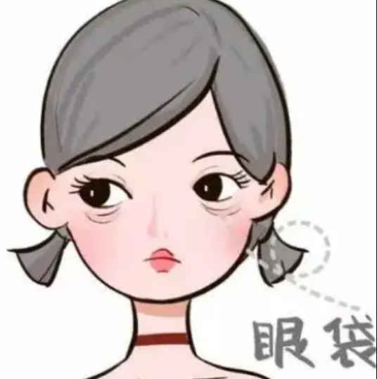 去眼袋手术