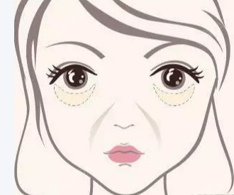 眼袋