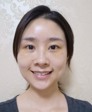 去眼袋手术
