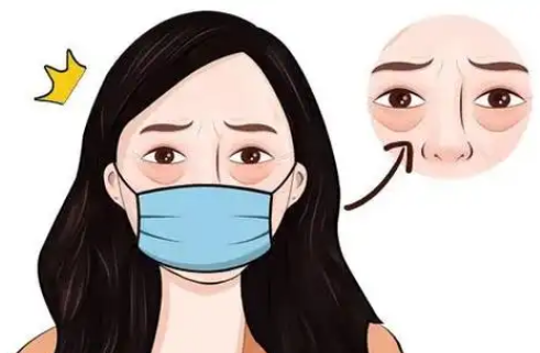 眼袋