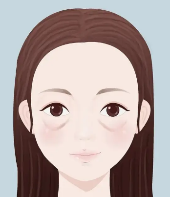 眼袋