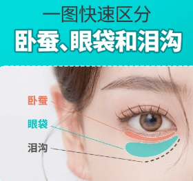 去眼袋手术