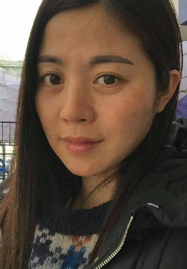 去眼袋手术
