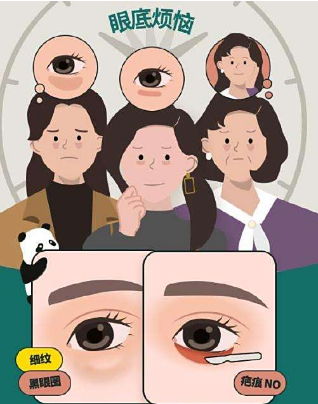 去眼袋手术