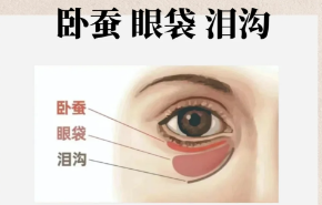 去眼袋手术