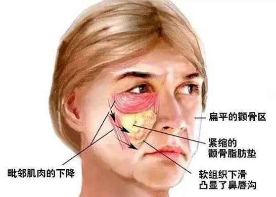 去眼袋手术