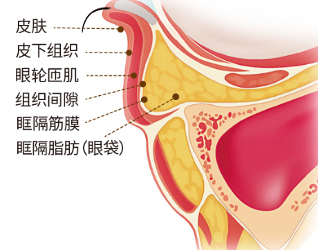 眼袋