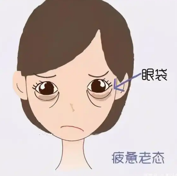 眼袋
