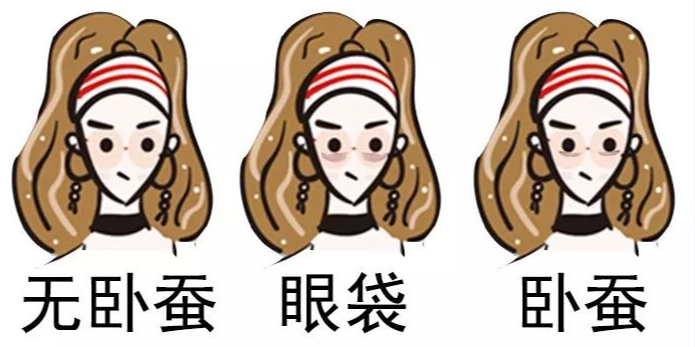 去眼袋手术