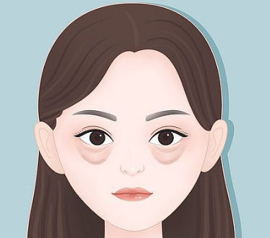 去眼袋手术