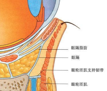 去眼袋手术