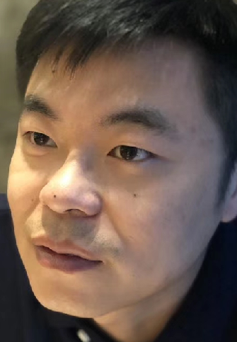 去眼袋手术