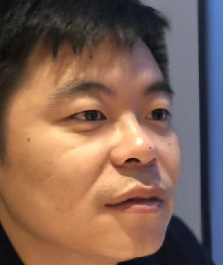 去眼袋手术