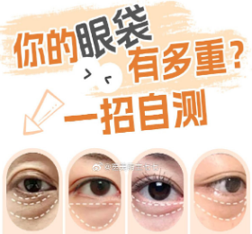 去眼袋手术