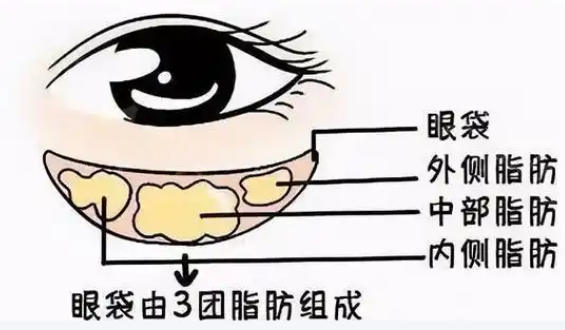 眼袋