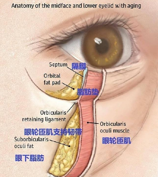 眼袋