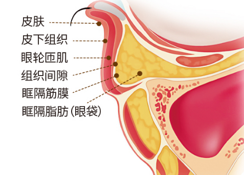 眼袋