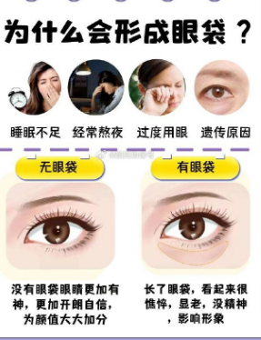 去眼袋手术