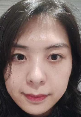 去眼袋手术