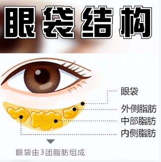 眼袋